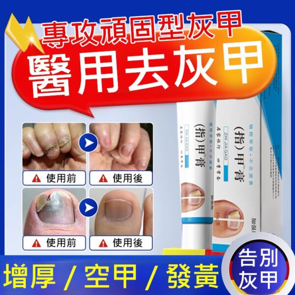 【無痛不復發】APGMA灰指甲膏：圖片 5