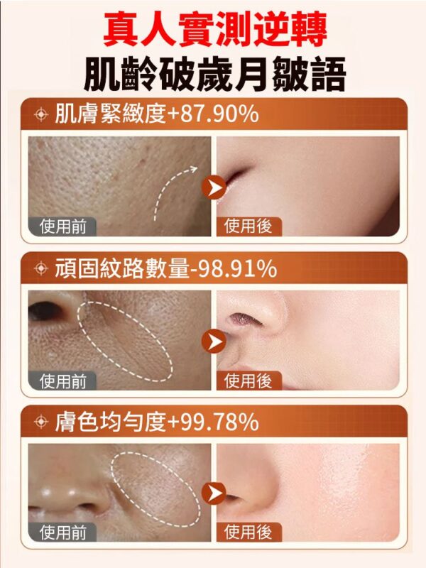 【秒去皺紋】NUOSILI依克多因逆齡精華：圖片 3
