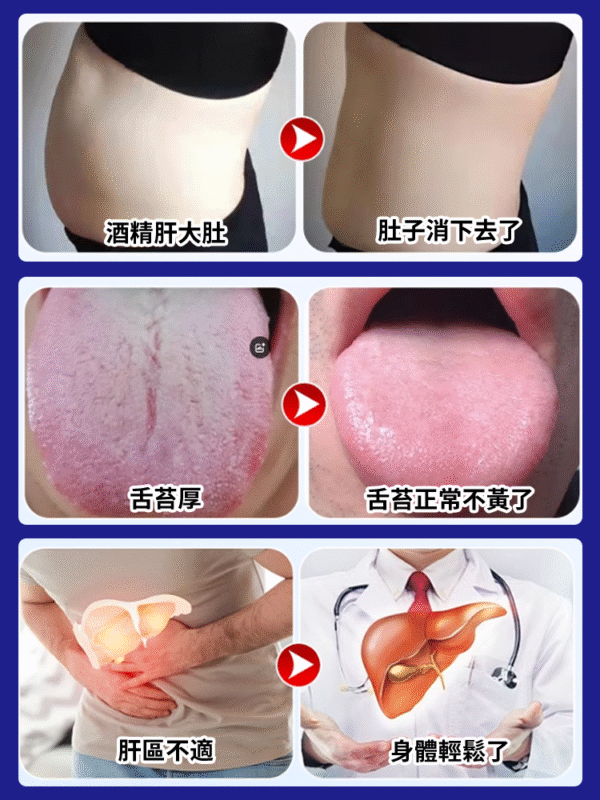 香港時珍大藥局水飛薊人參佛手貼：圖片 4