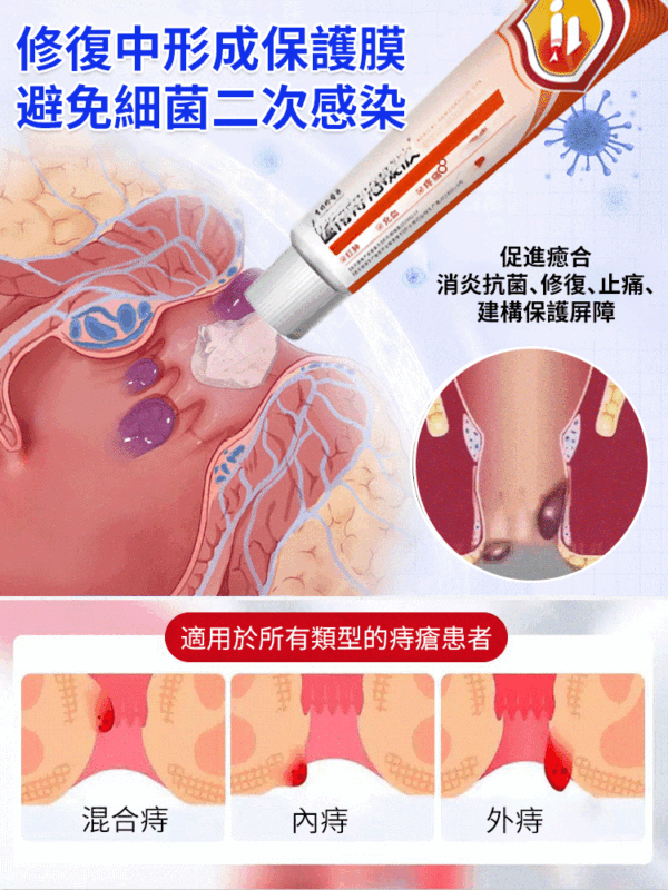 李時珍醫用痔瘡凝膠：圖片 5