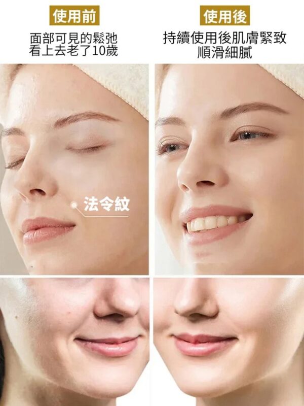 【7天法令紋消除】UMH凝水微晶法令紋淡化面膜：圖片 5