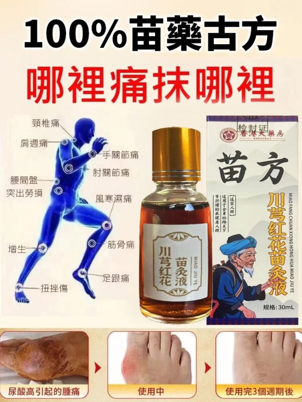 【哪痛塗哪】香港大藥房苗方川穹紅花苗灸液