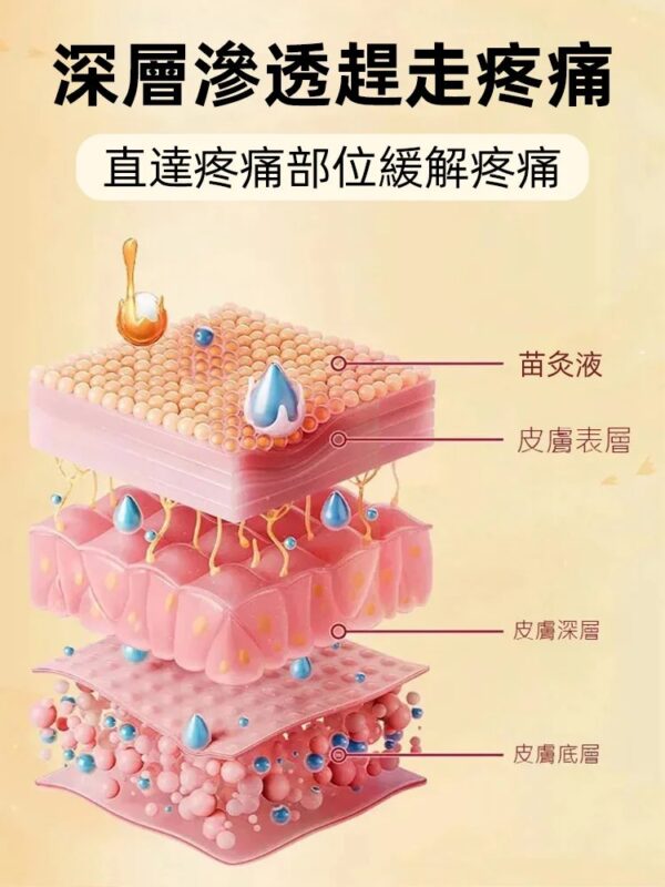 【哪痛塗哪】香港大藥房苗方川穹紅花苗灸液：圖片 4