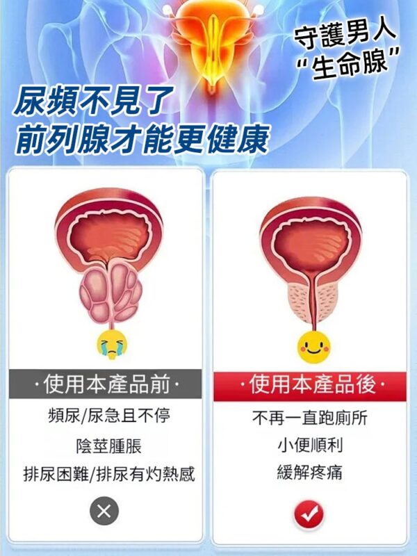 【尿頻天敵】蒲公英枳棋子地龍蛋白片：圖片 4